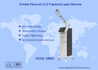 Pionowa frakcyjna maszyna laserowa do usuwania pigmentów usunięcie blizn