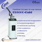 Magic Fractional Co2 Laser Maszyna CE Medycyna Zatwierdzona Z 10,6 Microns długości fali