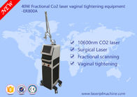 40w Co2 Fractional Laser Equipment / komercyjny sprzęt do dokręcania pochwy