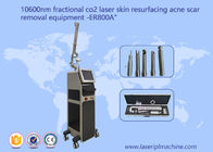 10600nm Cool Beam Fractional Co2 Laser Machine Do usuwania trądziku z bliznami