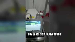30W RF Tube Fractional Co2 laser do usuwania blizn, zaciskania skóry