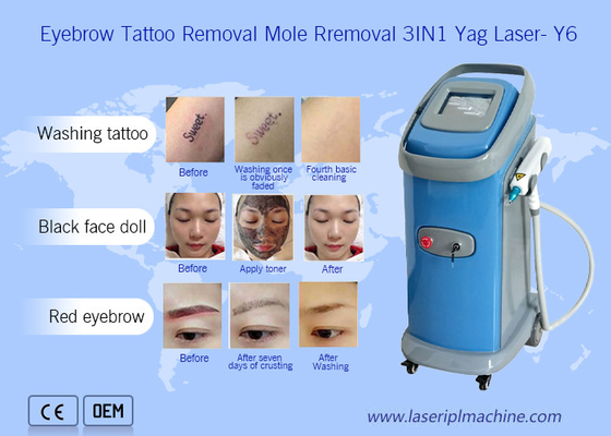 1064nm 532nm Nd Yag Laserowa maszyna do usuwania tatuaży Dermatologia