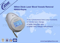 5HZ 980nm Dioda Laserowa maszyna do usuwania naczyń krwionośnych pająka