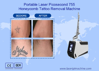 Urządzenie do usuwania laserowego tatuażu Nd Yag Picosecond 755nm 1064nm 532nm