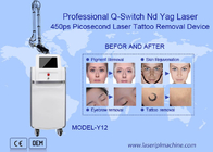 755nm Nd Yag Picosecond Laserowa maszyna do usuwania tatuażu