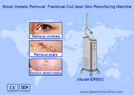RF Fractional CO2 Laser For Stretch Marks Scar Removal Vaginal Tightening Machine (RF frakcyjny laser CO2 do usuwania rozstępów)