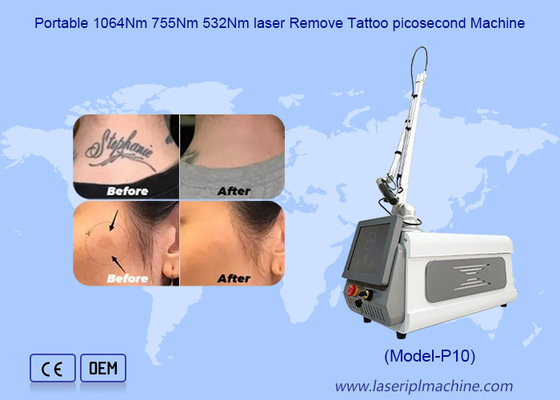 Przenośna maszyna do wybielania skóry Picosecond Tattoo Removal Nd Yag Laser Machine