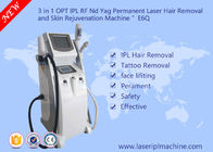 Klinika Odmładzanie skóry Sprzęt kosmetyczny / Ipl Sprzęt kosmetyczny Laserowe usuwanie tatuażu