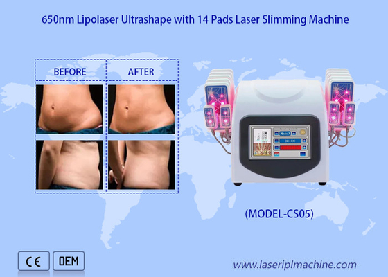 650nm Lipo Laser Pads Laserowa maszyna do liposukcji w celu zmniejszenia usuwania tłuszczu z cellulitu