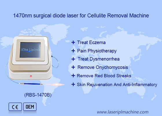 Dobra cena. 1470nm 980nm Dioda laserowa Lipoliza Chirurgia Urządzenie laserowe Rozpuszczalne w tłuszczu w Internecie