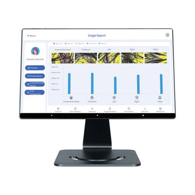 4 Języki Inteligentny Analizator Skóry Głowy AI, Pielęgnacja Skóry Głowy, Urządzenie do Celowanej Analizy Głowy